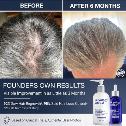 Guyology Labs™ Biotin Shampoo 1 Month Supply - With AnaGain™ - DHT Blockers For Thinning Hair - Anti Hair Loss Shampoo - Hair Growth Shampoo by Guyology Labs